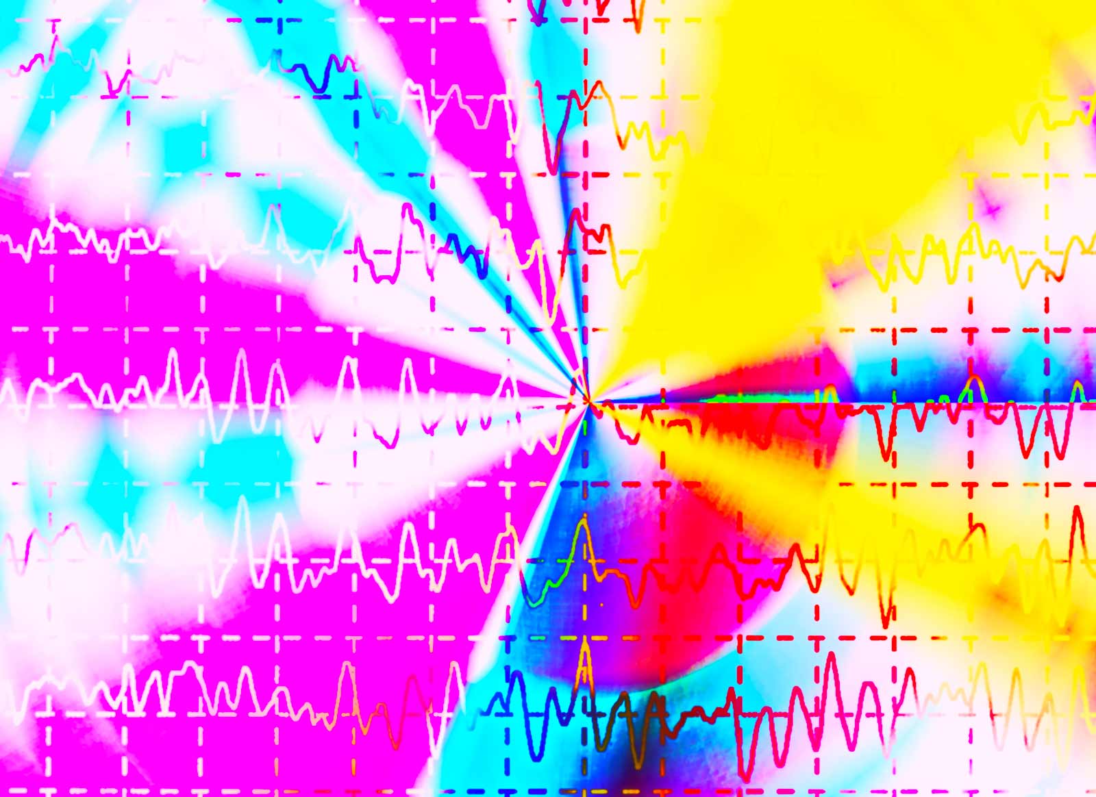 Image of a brain wave on anelectroencephalogram, EEG for epilepsy
